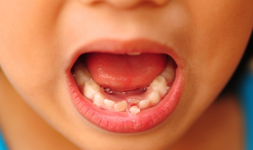 Everything You Want to Know About Your Child’s Primary Teeth